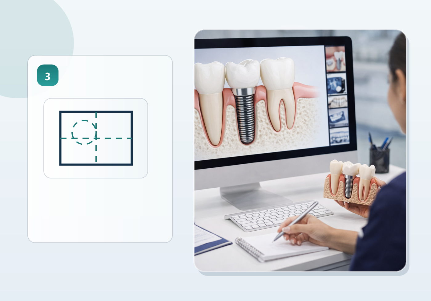 CBCT scan and surgeon review