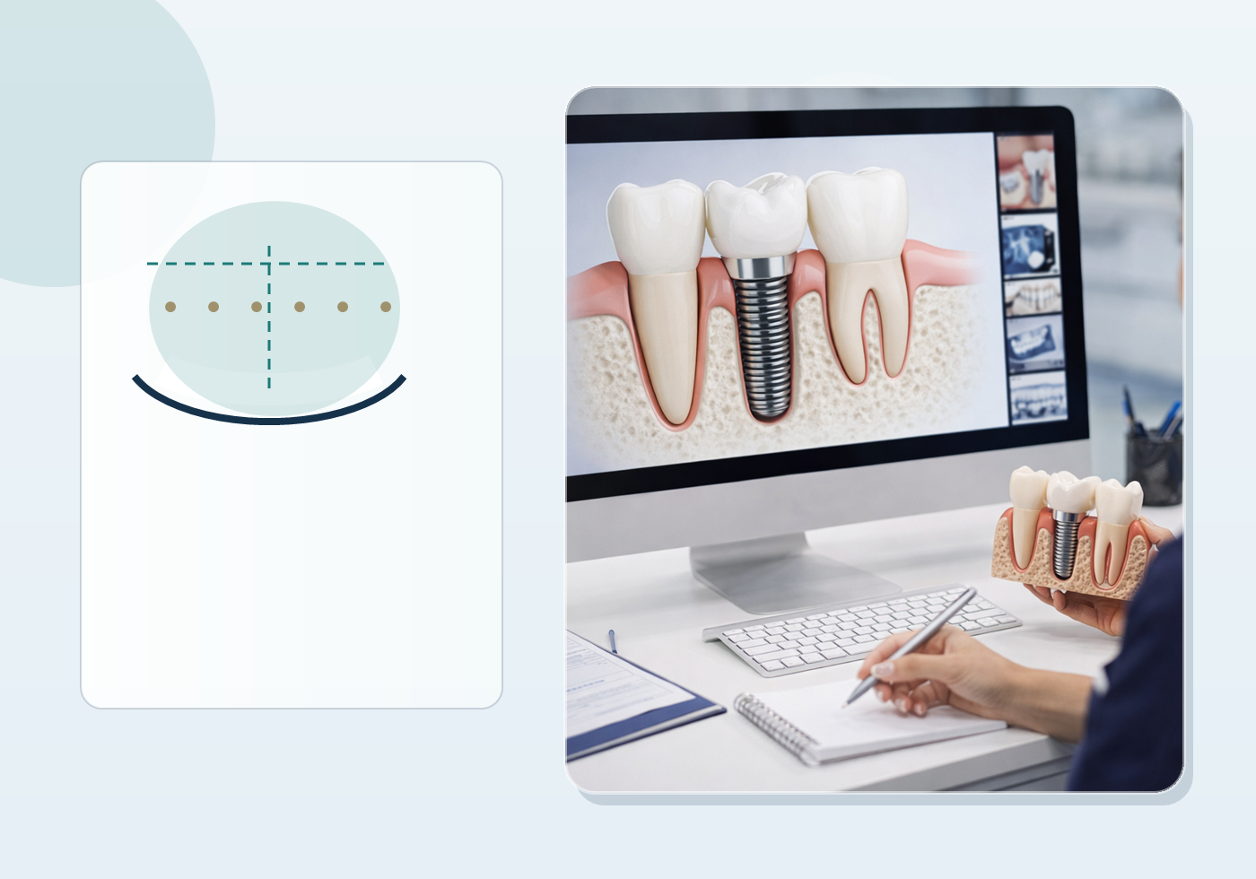 Digital Smile Design and Veneers