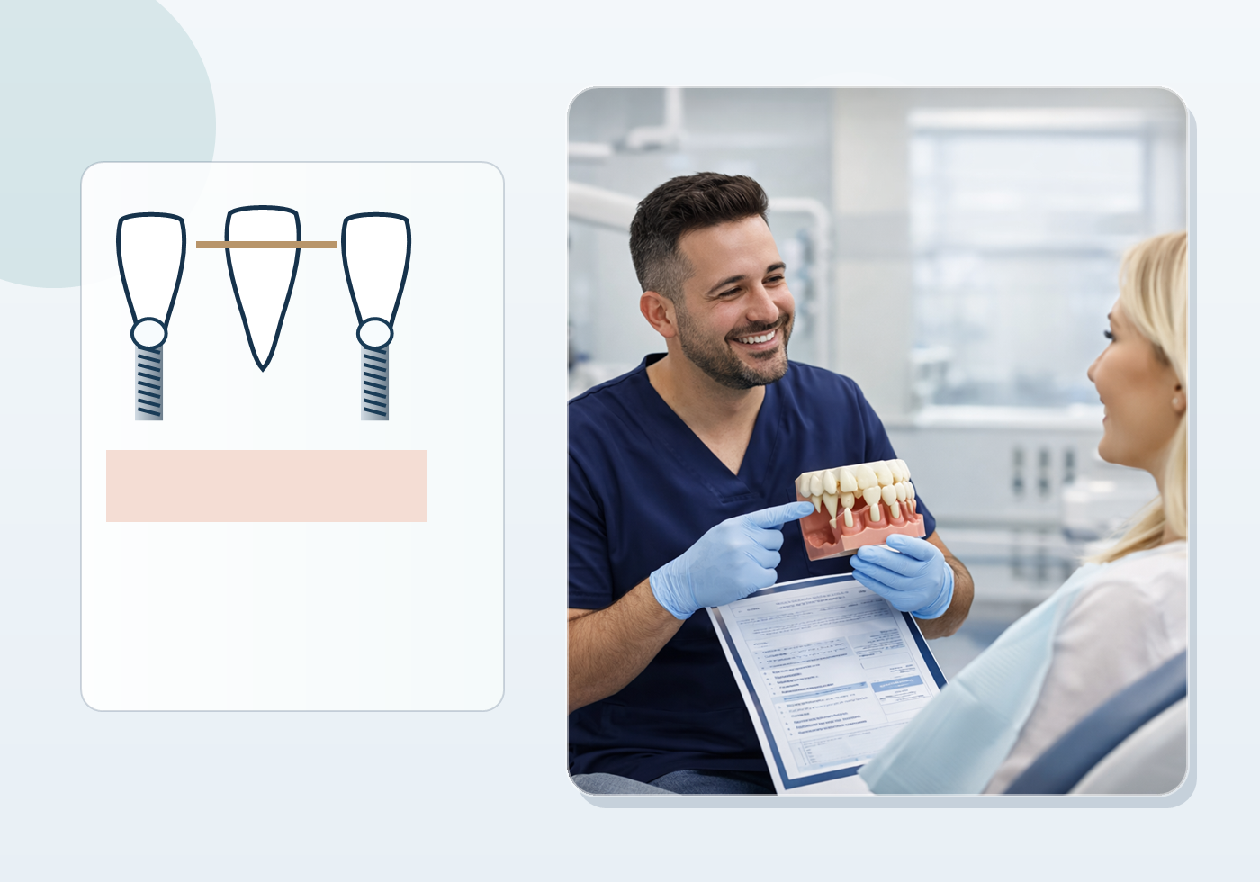 Implant-Supported Bridge