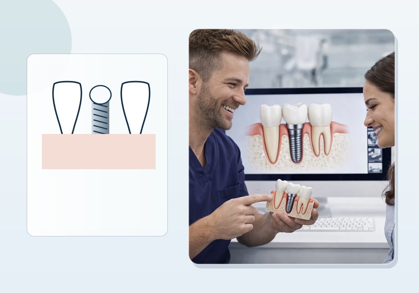 Single Dental Implant